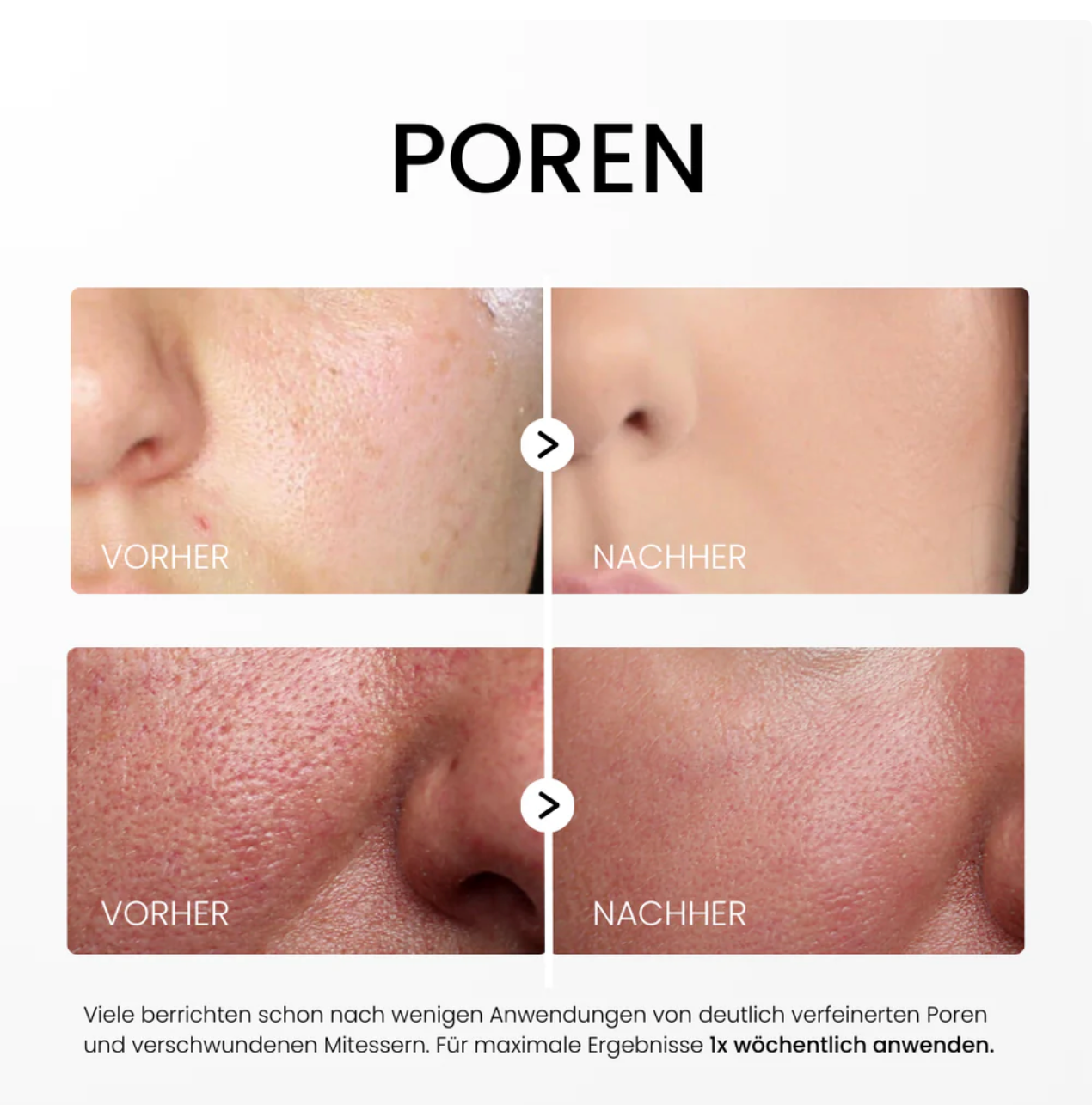 Rice Peel Glow Serum