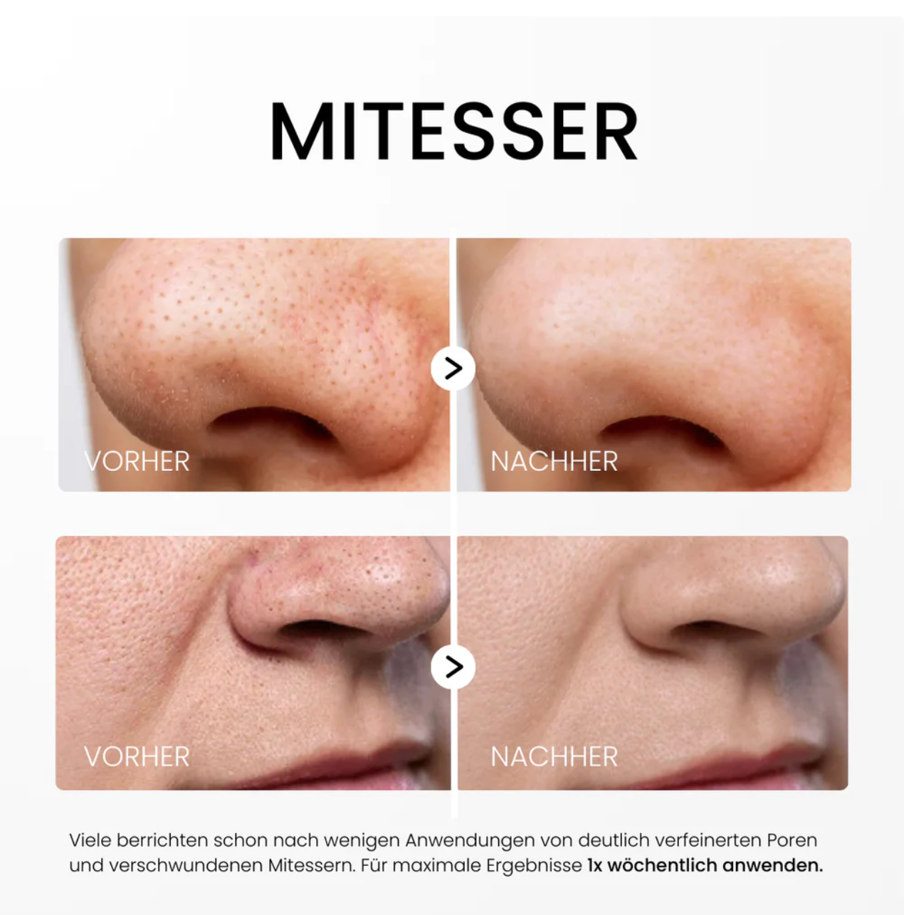 Rice Peel Glow Serum